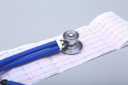 Stethoscope head and silver pen lying on cardiogram on clipboard pad. Cardio therapeutist assistance, physician make cardiac physical, pulse beat measure document, arrhythmia idea, pacemaker concept.の写真素材
