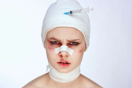 portrait of a woman facial injury health problems bruises pain close-upの写真素材