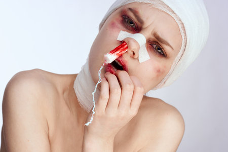 female patient tampon in the nose with blood injured face isolated background