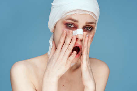 portrait of a woman bruised face medicine treatment injury isolated backgroundの写真素材