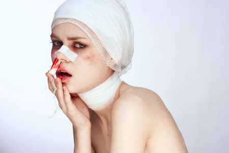 a person tampon in the nose with blood injured face close-upの写真素材