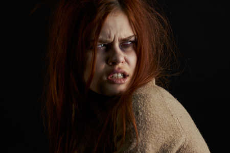 scared woman with bruises under her eyes beating depression abuseの写真素材