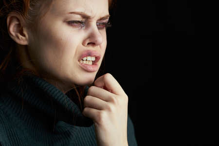 crying woman with black eye problems abuseの写真素材