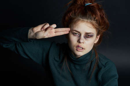 emotional women with black eye abuse discontent depressionの写真素材