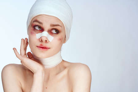 woman bruised face medicine treatment injury accident isolated backgroundの写真素材