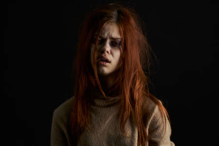 scared woman with bruises under her eyes beating depression abuseの写真素材