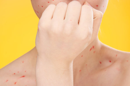 female face cropped view red dots on the face skin problems