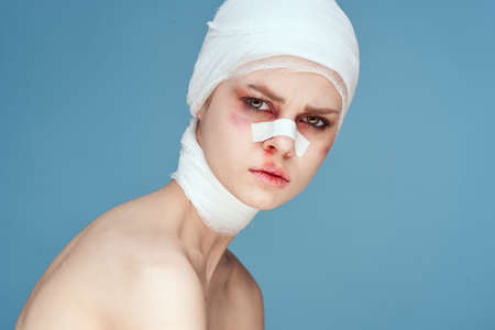 female patient plastic surgery operation bare shoulders studio lifestyleの写真素材