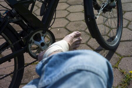 A man with injured leg in bandage sitting next to bicycle, outdoor closeup