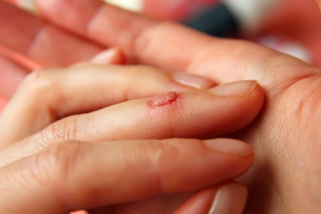 The cut on his finger female handの写真素材