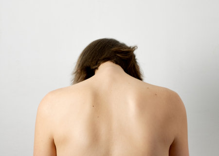 Example of neck hump and need for posture correctionの写真素材
