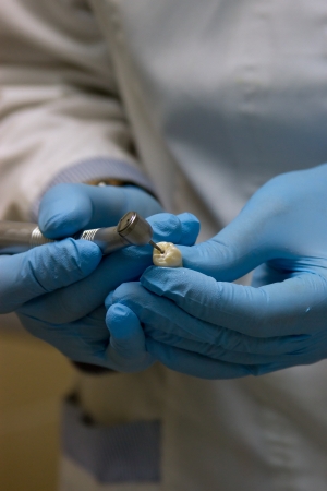 Dental surgeon molding prosthetic teeth with the aid of a dental drill and burr