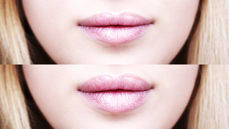 Part of face, young woman close up. Sexy plump lips after filler injection. Beauty concept.の写真素材