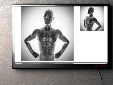 human bones radiography scan. x-ray  image