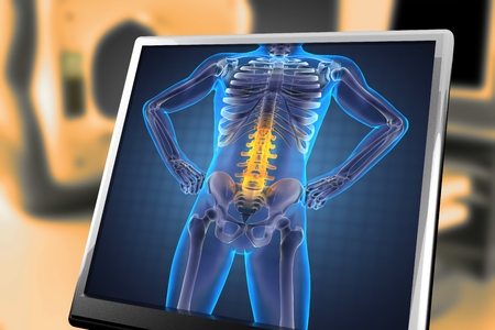 human radiography scanの写真素材