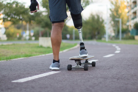 Close-up of person with disability on skateboard. Man with mechanical leg skateboarding in park on...
