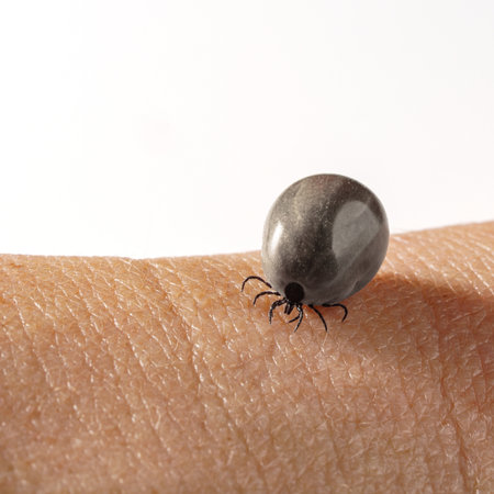 Engorged Tick Attached to Human Skin, Public Health Threat, Lyme Disease, Close-upの写真素材
