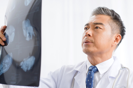 The doctor see x-raysの写真素材