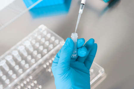 hands of a lab technician with a tube of blood sample and a rack with other samples / lab technician...