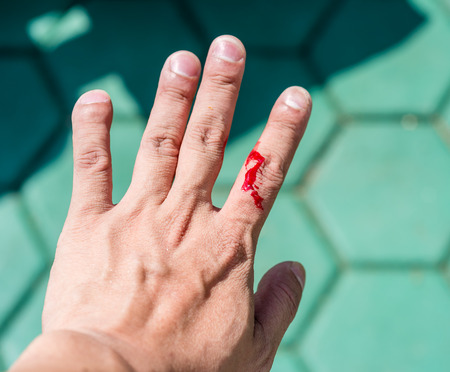 Real blood  on finger of a man's hand which caused by knife の写真素材