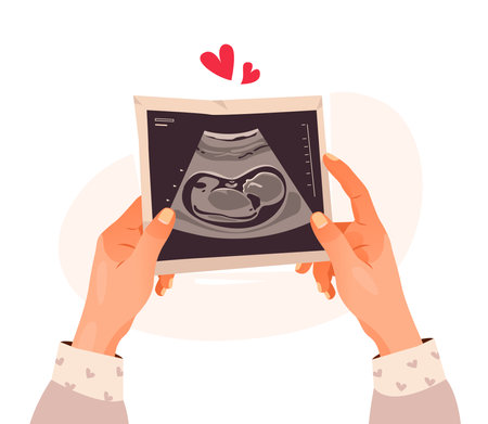 Hands holding a photo of a baby on ultrasound scan in the womb. Ultrasound of the child. Pregnancy. cartoon vector illustrationのイラスト素材