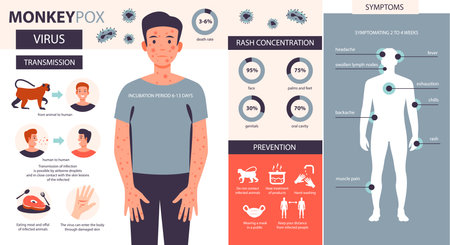 Monkey pox infographic. Infection, symptoms, prevention of the disease of monkey pox. Flat vector illustration.のイラスト素材