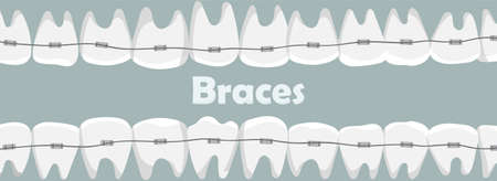 Banner with teeth in braces with the inscription.のイラスト素材