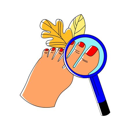 Vector flat with enlarged foot and magnifying glass, through which nail on finger is visible.のイラスト素材