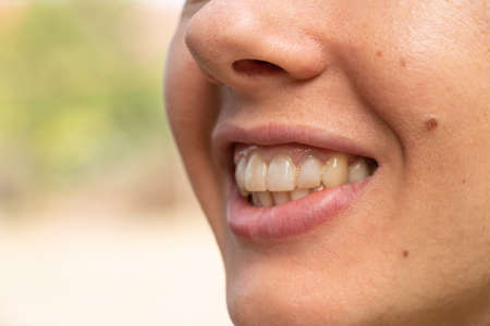 lush lips close-up of a young girl in daylight outdoors