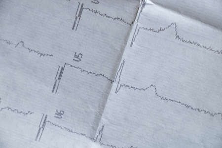 cardiogram on old paper as background macro photo