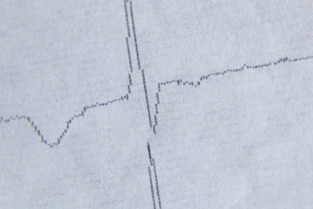 cardiogram on old paper as background macro photoの写真素材