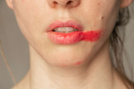 young girl with red lipstick on her lips without treatment, lipsの写真素材