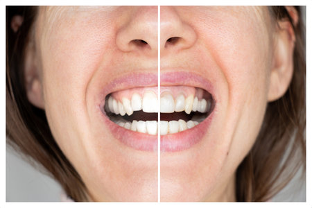 Women's teeth before and after bleaching an example on the same background, dentistry, an example...