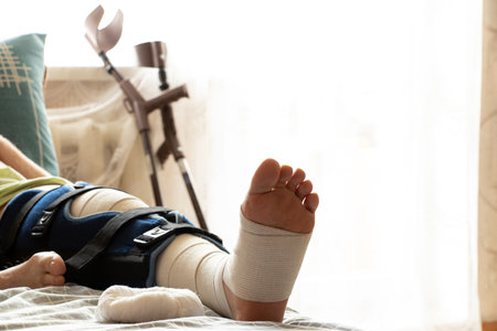 A man lies on a bed after surgery on his knees and crutches next to the bed in the apartment,...