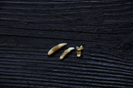 Three cat teeth pulled out after a visit to the dentist lie on a blackboard, teeth pulled out