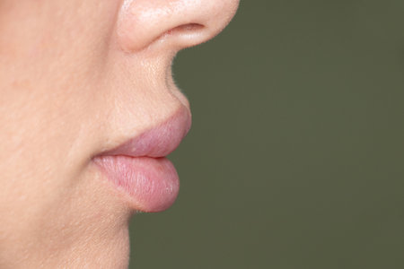 Female plump silicone lips close-up, cosmetic correction, lip augmentation, aesthetic procedure,...