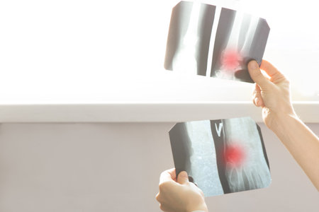 A doctor holds and examines X-rays of a fractured arm on a light screen. Medical diagnosis of...