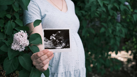 A pregnant woman holding an ultrasound picture
