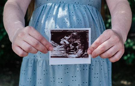 A woman is holding a baby ultrasound picture in her handsの写真素材