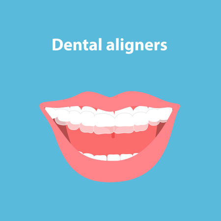 Mouth guard. Teeth with transparent braces. Alignment of teeth by aligners. Orthodontic dentistry concept. Dental care. Vector illustration isolated on blue background.のイラスト素材