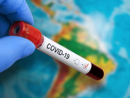 Coronavirus epidemic in South Americaの写真素材