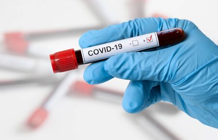 Test for coronavirus positive result