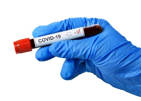 Hand in disposable glove isolated on white. Tube with coronavirus test in hand.の写真素材