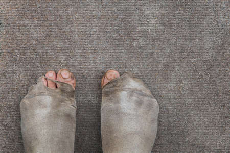 Dirty male feet in leaky worn out socks. Poverty. Background.の写真素材