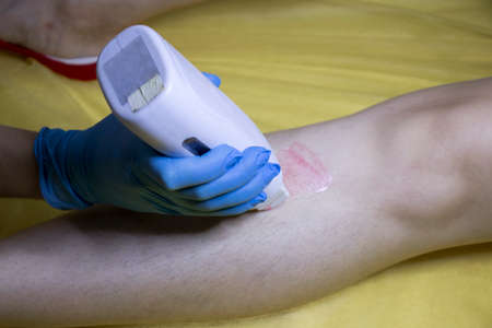 Beautician in blue gloves makes wax depilation.の写真素材