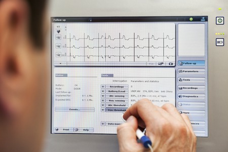 A doctor is checking a readings from a pacemaker on a monitor.の写真素材