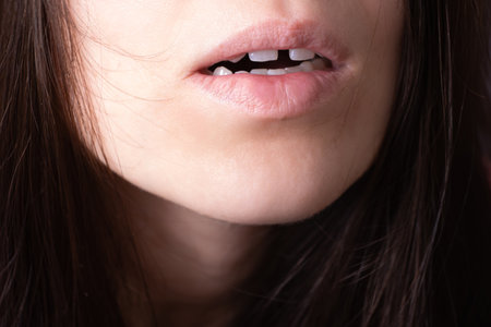 Close up of woman's open mouth with gap teeht. Lips and unusual teeth.の写真素材