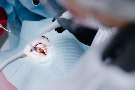 The process of cleaning saliva in the dental office. Dental proceduresの写真素材