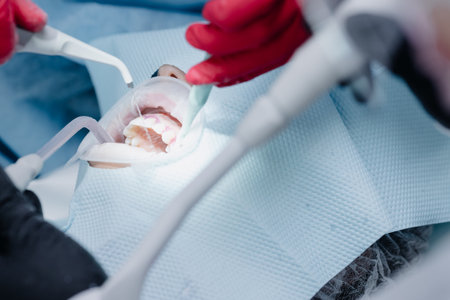 Female dentists treat the patients teeth. Cleaning the mouth with water. Closeの写真素材