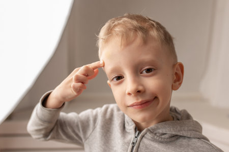 A smiling boy shows a bruise on his head. It doesn't hurt anymore.の写真素材